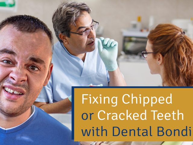 Fixing Chipped or Cracked Teeth with Dental Bonding (featured image)