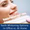 Teeth Whitening Options: In-Office vs. At-Home (featured image)
