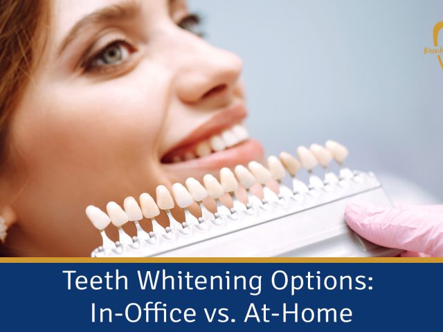 Teeth Whitening Options: In-Office vs. At-Home (featured image)